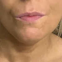 Holytits Alaston