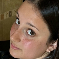 keshaortegafree Alaston