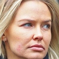 Lara Bingle Alaston
