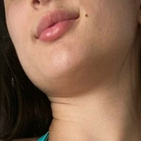 sweetdafnefree Alaston